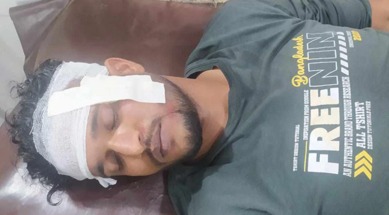 স্বতন্ত্র প্রার্থীর সমর্থকদের ওপর হামলার অভিযোগ উঠেছে নৌকার সমর্থকদের বিরুদ্ধে